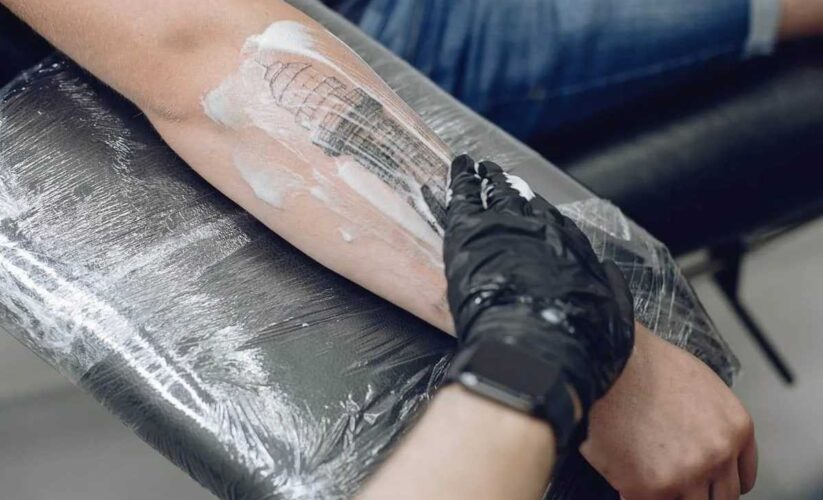 How Tattoo Removal Can Boost Your Self Confidence   